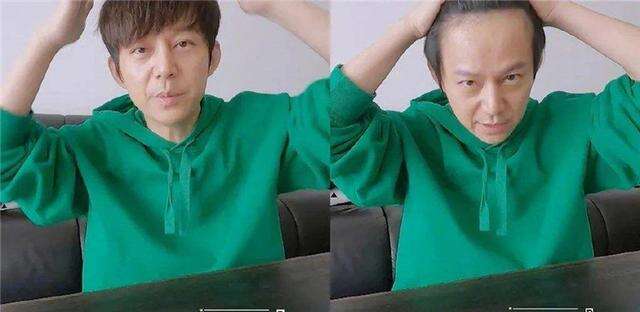 男人发际线后移等于整容!何炅没刘海直接50岁,胡歌也难逃考验