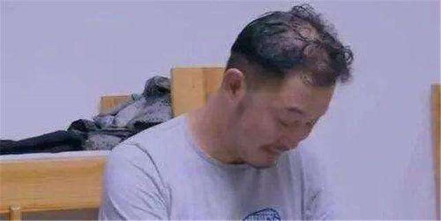 男人发际线后移等于整容!何炅没刘海直接50岁,胡歌也难逃考验
