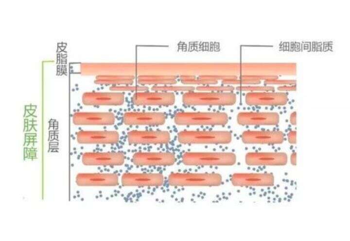 要想改善敏感肌,首先要了解敏感肌是怎么形成的?