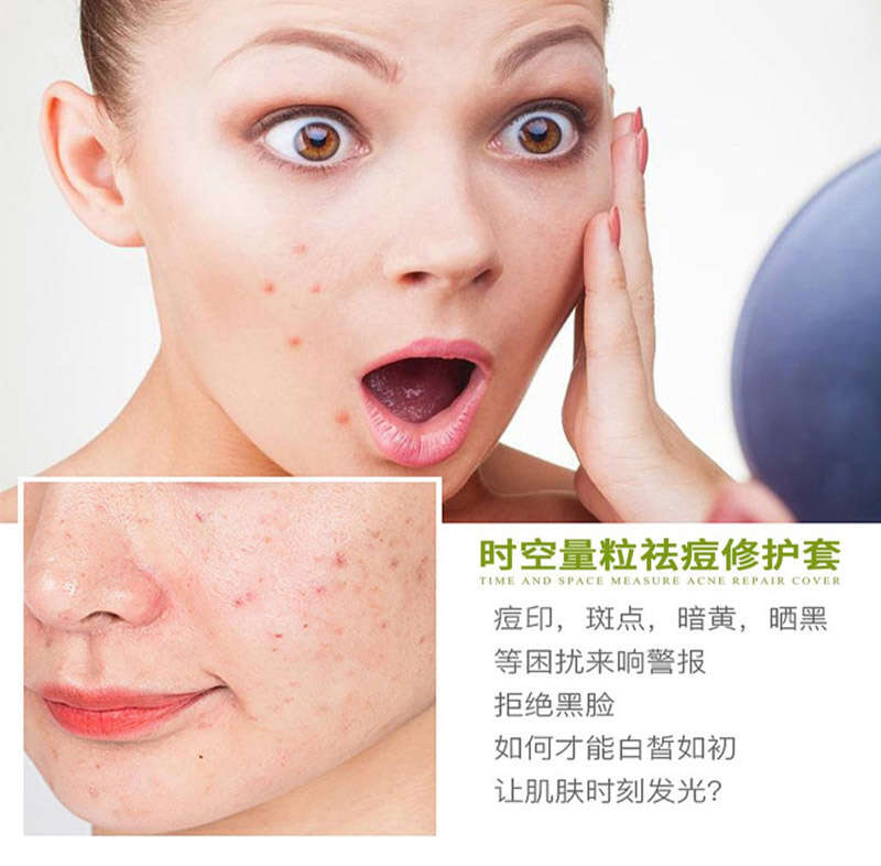 脸上长痘痘怎么快速祛痘?