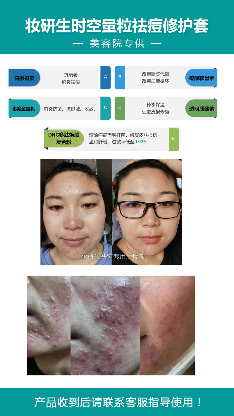 脸上长痘痘怎么快速祛痘?