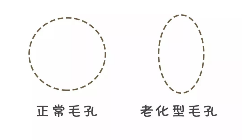 解决毛孔粗大的护肤心得,你需要知道的都在这里!