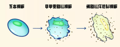 关于去除法令纹的护肤技巧有哪些?详细了解法令纹