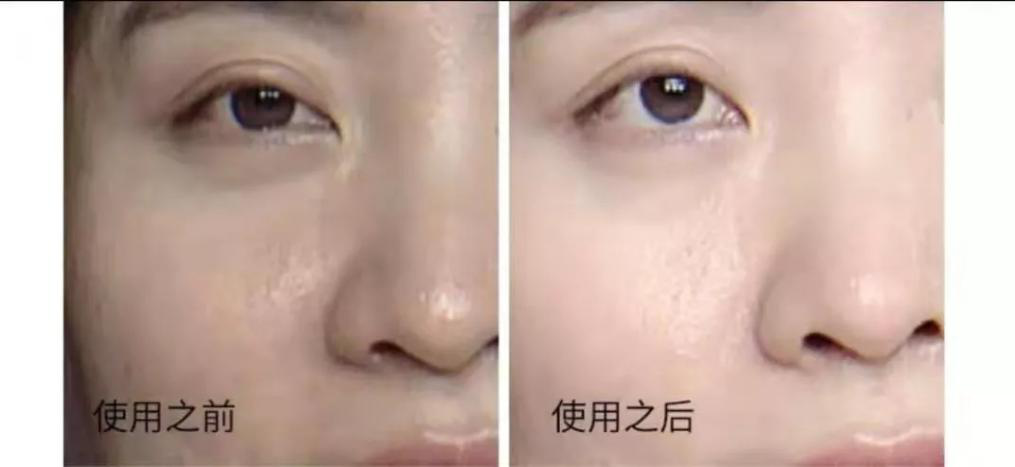如何抗老?抗老护肤心得,鉴别初老状态分分钟get起来!