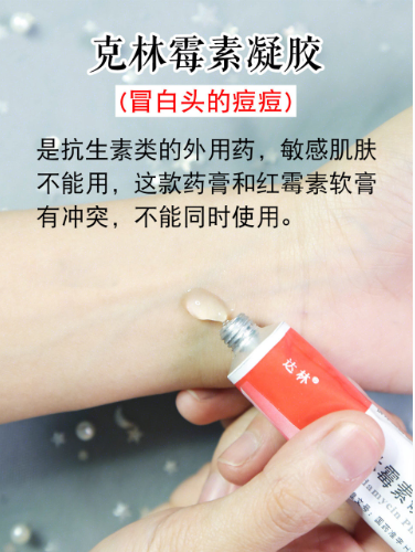 祛痘心得|6大祛痘药膏,对肌肤真的没有刺激吗?