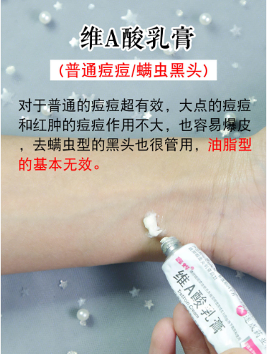 祛痘心得|6大祛痘药膏,对肌肤真的没有刺激吗?