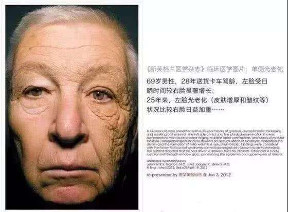 护肤心得:面膜究竟能不能天天敷?是时候给出答案了!