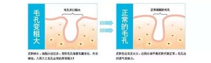护肤心得:28天逆袭婴儿肌,跟粗毛孔说拜拜!