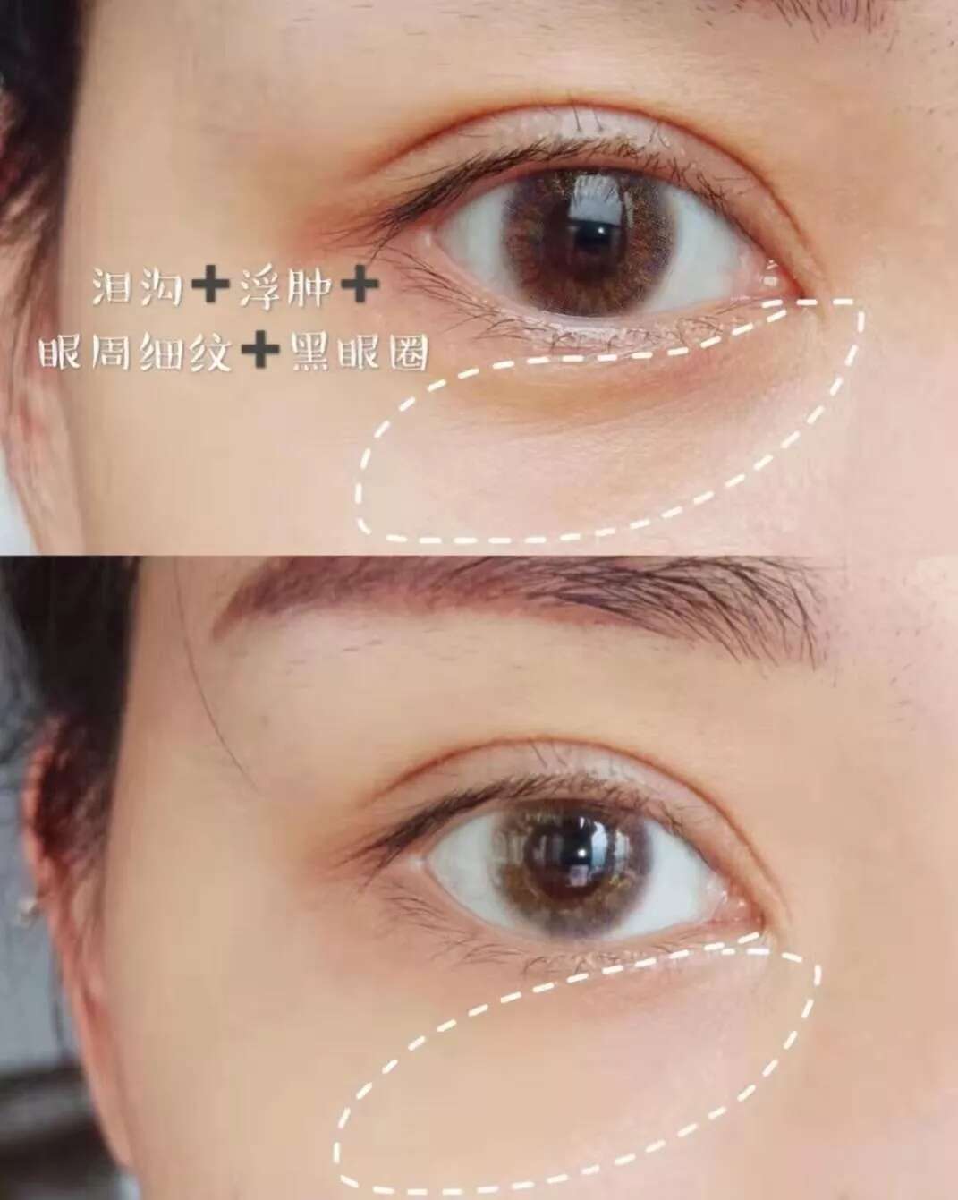眼部细纹黑眼圈怎么办?这有一份“眼部肌肤”按摩指南
