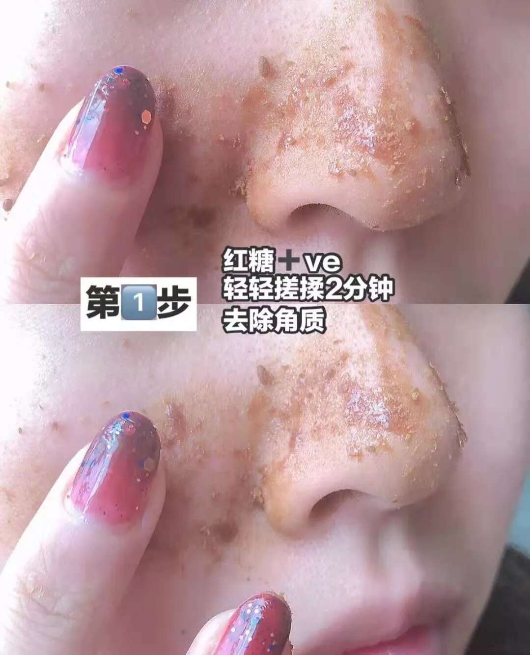 护肤技巧|毛孔粗大干纹怎么办,教你3步收毛孔,改善干纹!