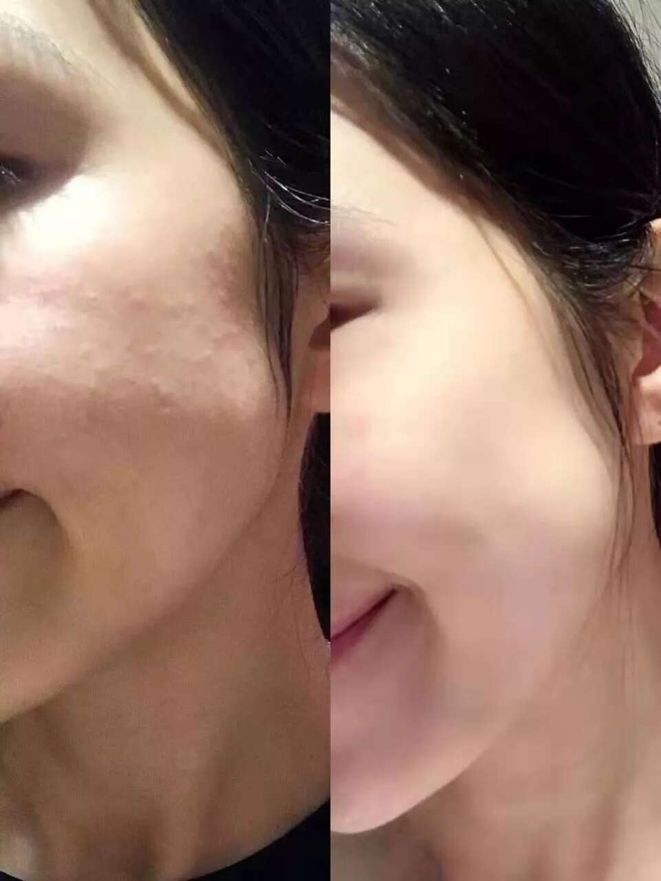 护肤心得干货丨7天密集修复过敏脸部肌肤!