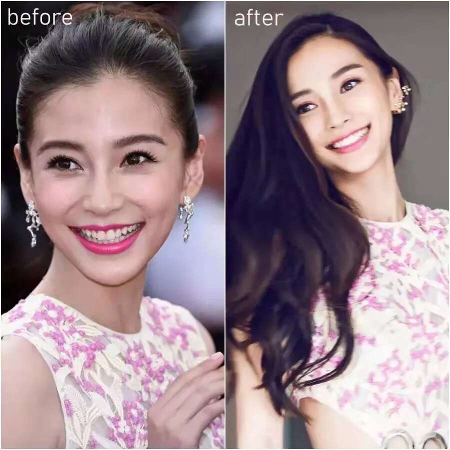 除了发量,最暴露年龄的可能是这两道法令纹