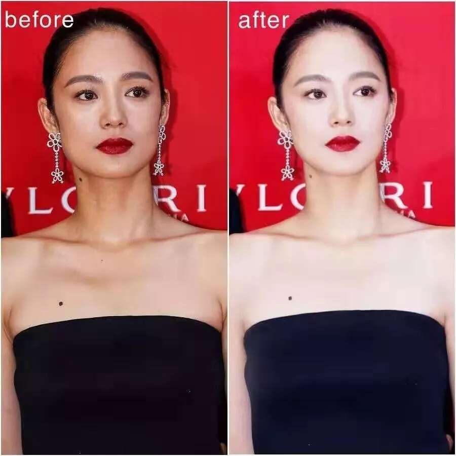 除了发量,最暴露年龄的可能是这两道法令纹