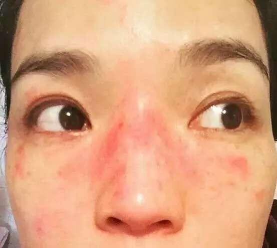 护肤心得|如何判断肤质?肤质的基本类型对照表