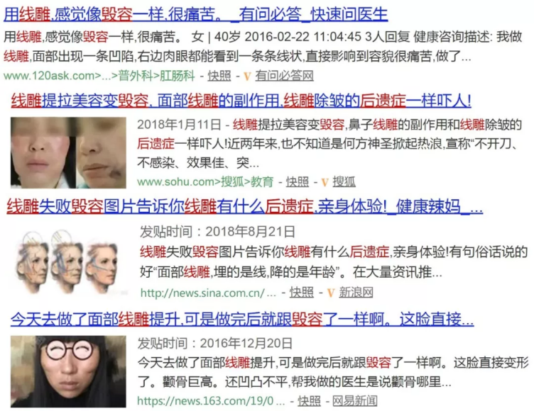 用两个月工资做的线雕!还不如590元买的祛皱精华好用?