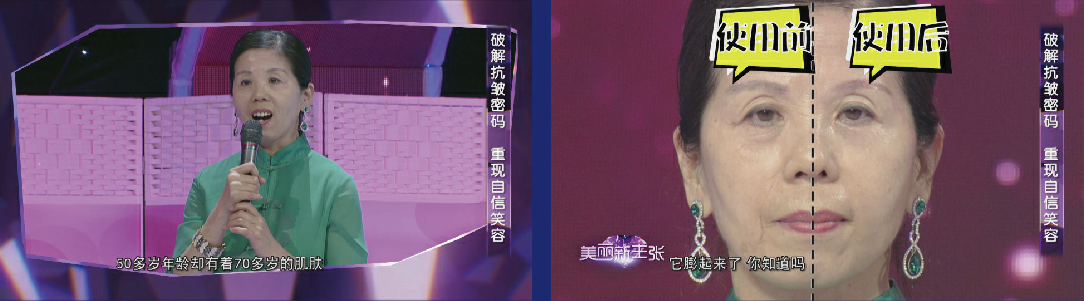 用两个月工资做的线雕!还不如590元买的祛皱精华好用?