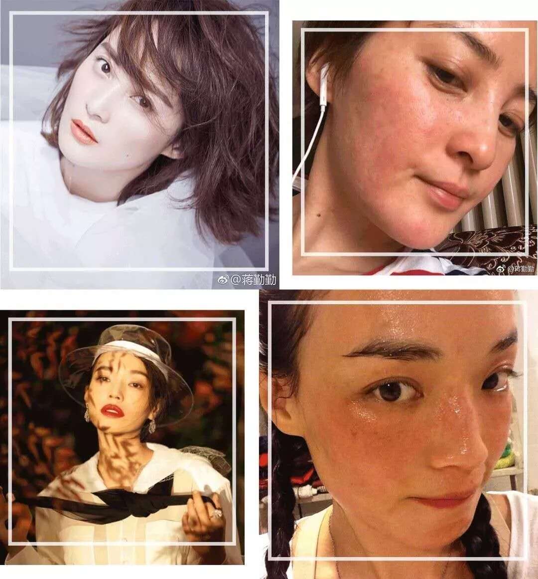 皮肤八大现象(五)丨敏感肌导致皮肤角质层薄的正确护理方法!