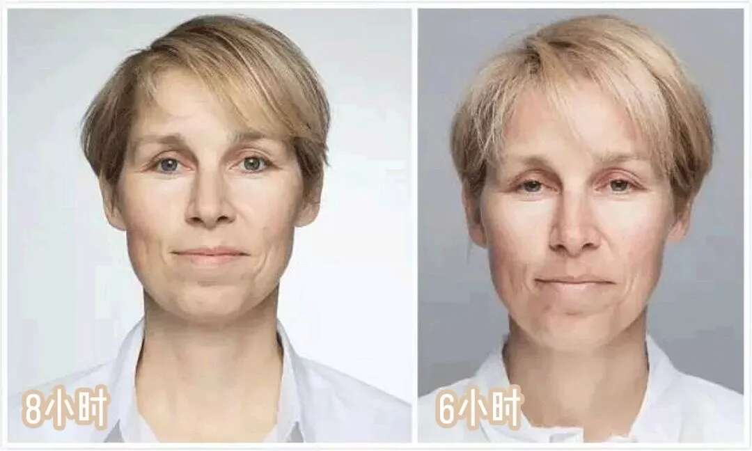 皮肤八大现象(六)丨怎样解决皮肤老化松弛的问题?
