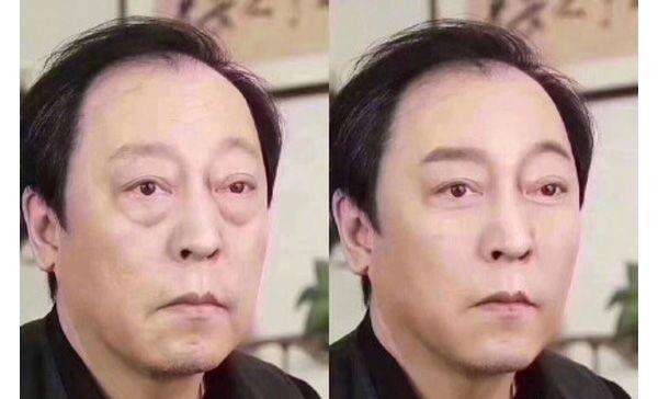 皮肤八大现象(七)丨“眼部衰老”的正确护理方法?
