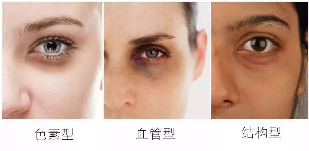 皮肤八大现象(七)丨“眼部衰老”的正确护理方法?