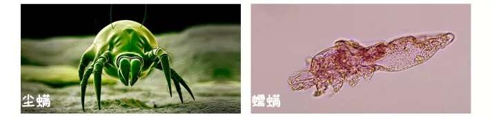 怎么祛痘?认清痘痘形成原因,别再信想祛痘先除螨的鬼话!