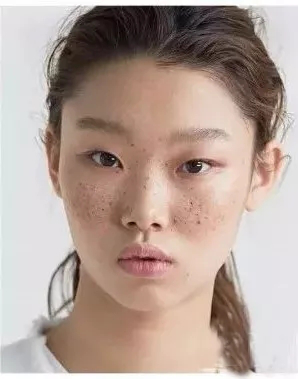 换季时候,皮肤过敏要怎么护肤?