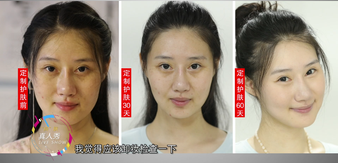 换肤真人秀是真的吗?定制护肤效果好吗?
