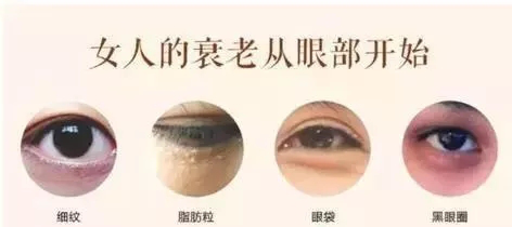 黑眼圈、细纹、脂肪粒?这些眼部问题到底应该怎么解决?