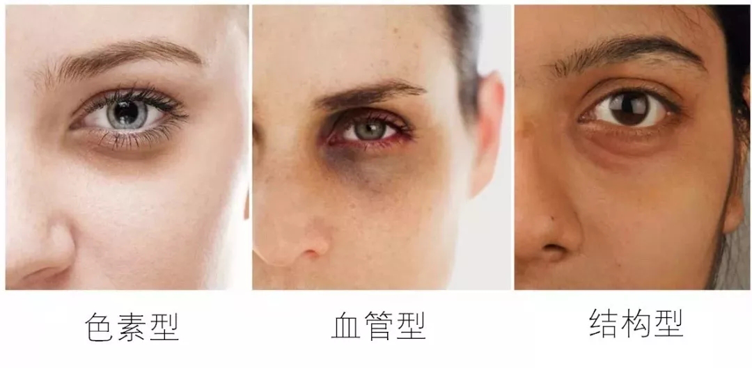 黑眼圈、细纹、脂肪粒?这些眼部问题到底应该怎么解决?