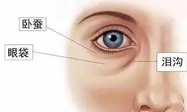 黑眼圈、细纹、脂肪粒?这些眼部问题到底应该怎么解决?