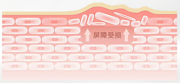 皮肤屏障到底是什么?该如何修护皮肤屏障?