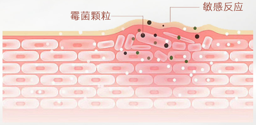 皮肤屏障到底是什么?该如何修护皮肤屏障?