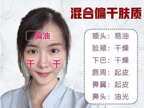 不同肤质怎样选护肤品?护肤品的选择技巧