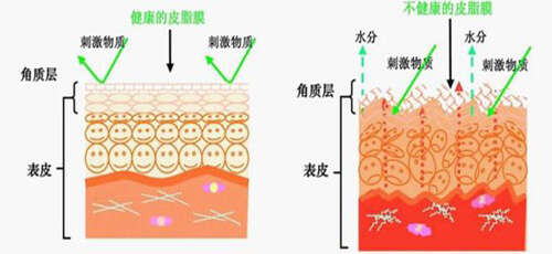 为什么皮肤保湿能力差?只因做了这些错误行为