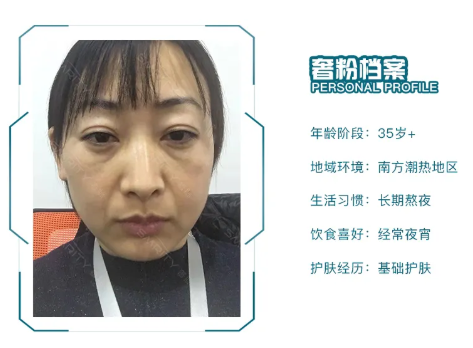 皮肤暗沉发黄怎么办?助你撕掉“黄脸婆”标签!