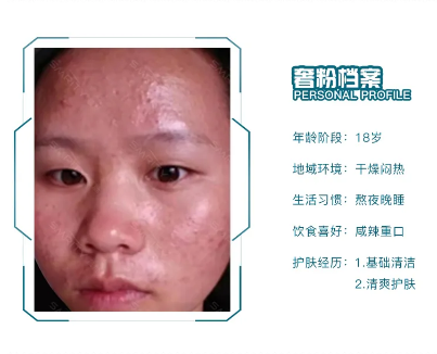 谁说油性皮肤就不缺水?夏季油皮的护肤心得