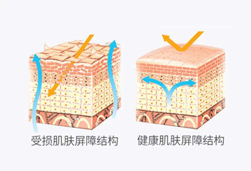 脸上有斑怎么调理?解决色斑的困扰,只比别人多做了这一点