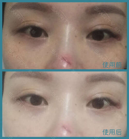 脸上有斑怎么调理?解决色斑的困扰,只比别人多做了这一点