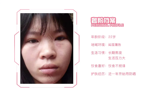 如何抗衰老?女人抗衰老要趁早,一起来看看抗老护肤心得