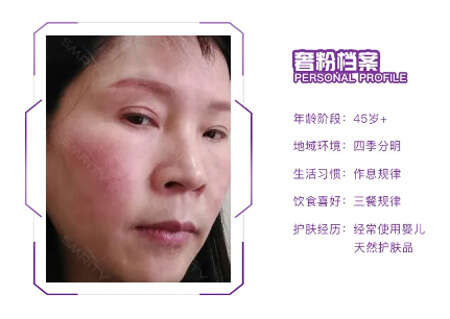敏感肌肤用什么护肤品?运用精准护肤方案修复敏感肌