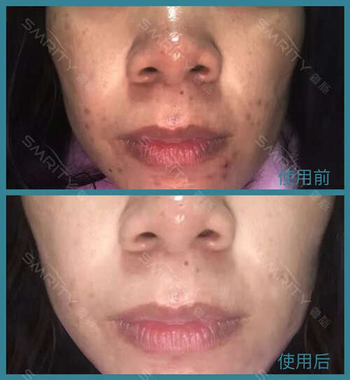 女人35岁以后怎么保养?面对肤色暗沉松弛敏感,看看她的护肤经历