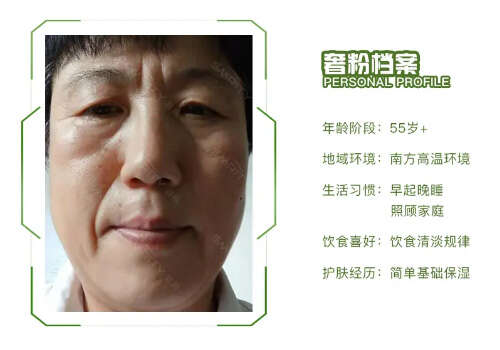 法令纹怎么消除?了解法令纹的形成原因及应对方案