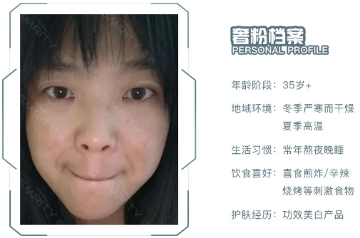为什么你的肌肤问题四季常在?四季护肤重点赶紧看看吧