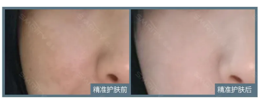 为什么你的肌肤问题四季常在?四季护肤重点赶紧看看吧