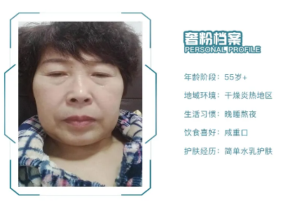 如何去眼部细纹?眼部细纹产生的原因
