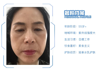 如何抗衰老,抗老越早越好皮肤抗衰老手册分享