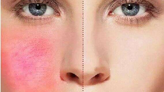 为什么男生不护肤比女生的皮肤好?女性护肤技巧,抗衰要注意这些