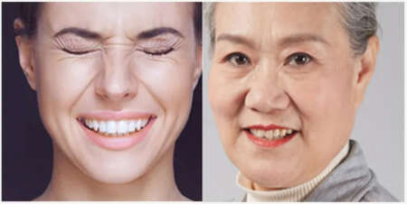 抗皱没效果?皱纹形成的原因,你可能忽略了这些因素