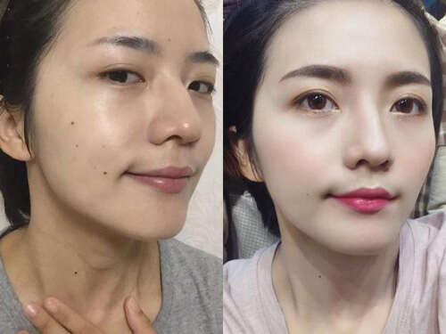 黄脸婆怎么提亮肤色?提亮肤色的护肤技巧
