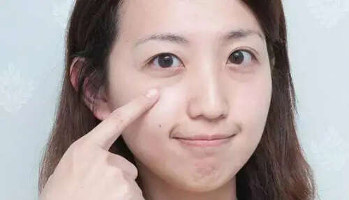 黑眼圈很重怎么去除?不同类型的黑眼圈护肤技巧
